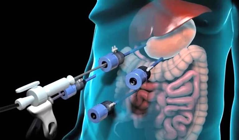 Medikal Animasyon - Kripto Animation Studio